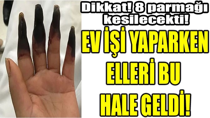 EV  YAPARKEN ELLER BU  HALE GELD!