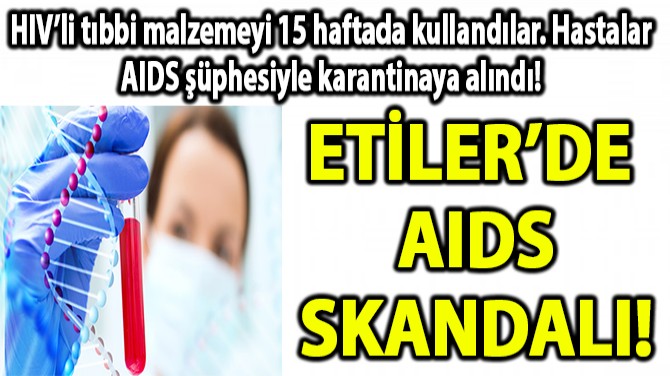 ETLERDE AIDS SKANDALI!