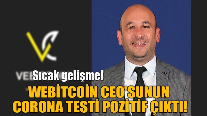 WEBTCON CEO'SUNUN  CORONA TEST POZTF IKTI!